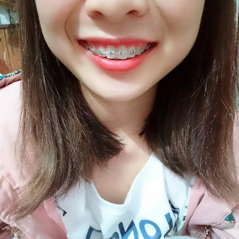 Đi niềng răng, tôi bị người yêu đề nghị chia tay - 1
