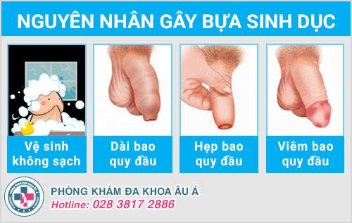 hình ảnh bựa sinh dục ở nam