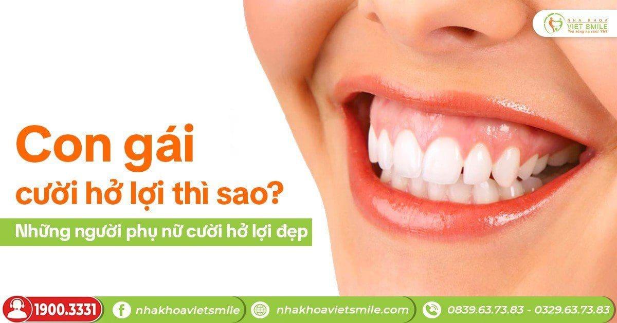 Con gái cười hở lợi thì sao? Những người phụ nữ cười hở lợi đẹp