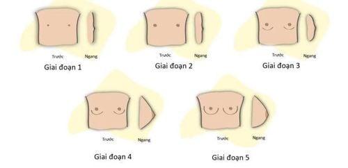 Các giai đoạn phát triển ngực ở nữ giới